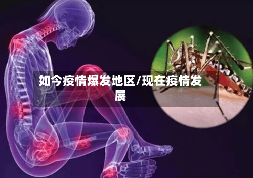 如今疫情爆发地区/现在疫情发展