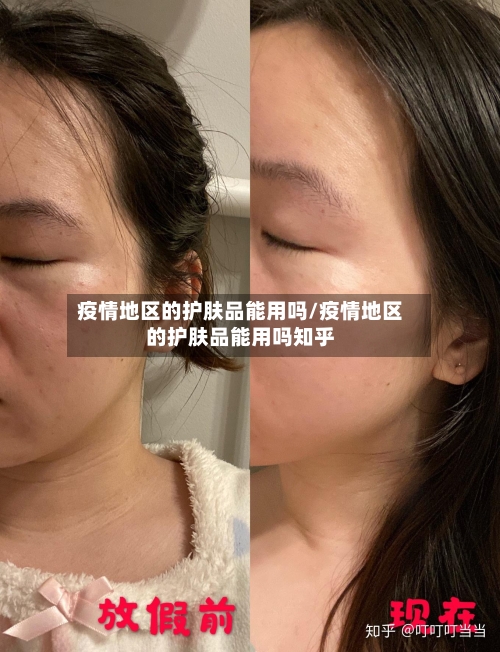 疫情地区的护肤品能用吗/疫情地区的护肤品能用吗知乎